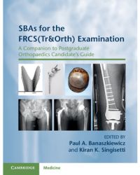 Sbas for the Frcs tr orth Examination A Companion to Postgraduate Orthopaedics Candidate s Guide - P
