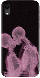 Husa din silicon compatibila cu Apple iPhone XR - model X Ray 