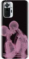 Husa din silicon compatibila cu Xiaomi Redmi Note 10 Pro - model X Ray 