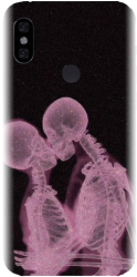 Husa din silicon compatibila cu Xiaomi Redmi Note 6 - model X Ray 