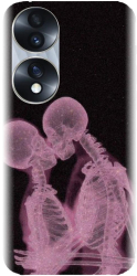 Husa din silicon compatibila cu Huawei Honor 70 - model X Ray 
