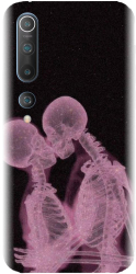 Husa din silicon compatibila cu Xiaomi Mi 10 Pro - model X Ray 