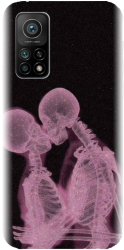 Husa din silicon compatibila cu Xiaomi Mi 10t Pro 5g - model X Ray 