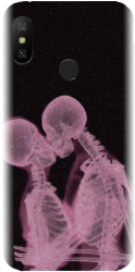Husa din silicon compatibila cu Xiaomi Mi A2 Lite - model X Ray 