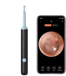 Endoscop smart pentru curatare a urechilor camera 5MP 100 Pixel Full HD si lumina LED X 6 Wi-fi accesorii incluse kit de incarcare bate 