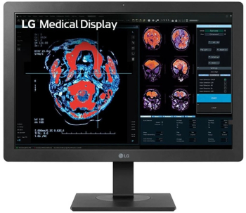 Monitor 23.8 inch LED LG Diagnostic 24HR513C-B.AEU Full HD 60 Hz 5 ms Internal Front Calibration Sensor, Negru 